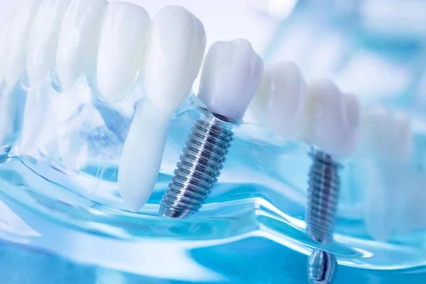Dentist Techniques for Early Detection of Oral Health Problems